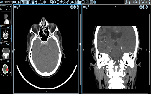 IMS Multimonitor Extension :: Multimonitor position helper