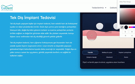 Implant App :: Web sayfalarındaki implant içeriklerini daha iyi incelemek için arkaplan ve yazı renklerini istediğin gibi ayarla