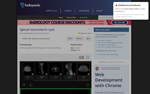 Image Downloader for Radiopaedia :: Download Radiopaedia case images as organized ZIP files