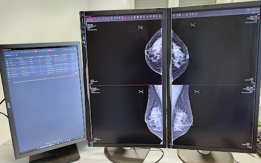 MedDream browser extension for multi-monitors (beta) :: MedDream DICOM Viewer browser extension for multi-monitors (beta)