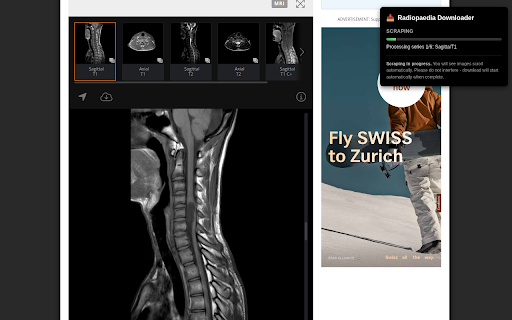 Image Downloader for Radiopaedia :: Download Radiopaedia case images as organized ZIP files